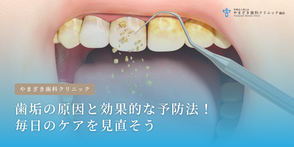歯垢の原因と効果的な予防法！毎日のケアを見直そう