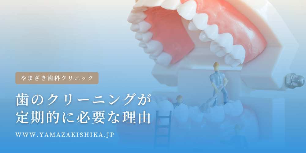 歯のクリーニングが定期的に必要な理由