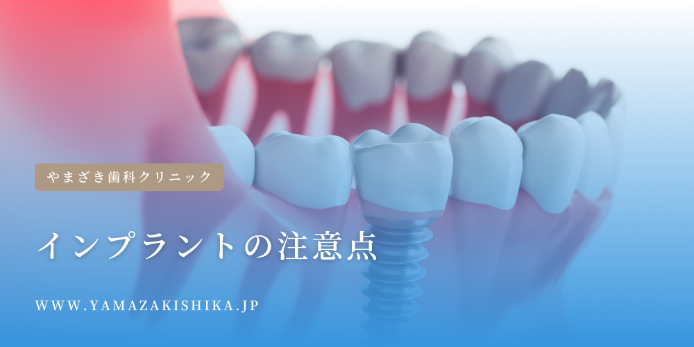 インプラントの注意点