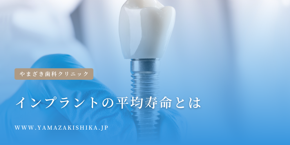 インプラントの平均寿命
