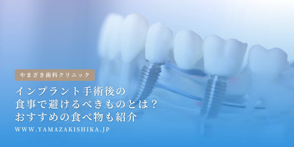 インプラント手術後の食事で避けるべきものとは？おすすめの食べ物も紹介