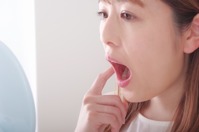 歯肉炎