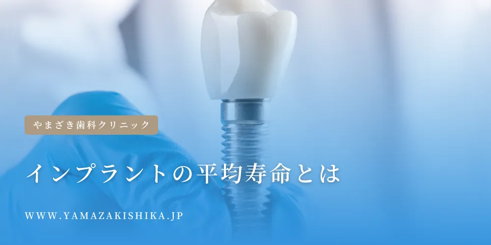 2024年10月3日_インプラントの平均寿命とは