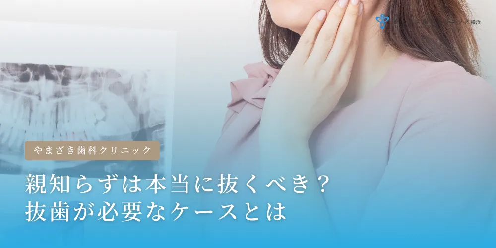 2025年4月16日_ 親知らずは本当に抜くべき？抜歯が必要なケースとは