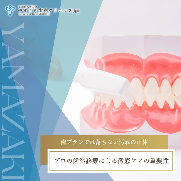 2026年4月17日_歯ブラシでは落ちない汚れの正体｜プロの歯科診療による徹底ケアの重要性