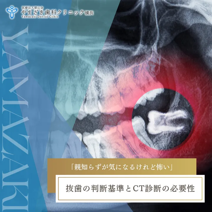 2026年8月21日_「親知らずが気になるけれど怖い」｜抜歯の判断基準とCT診断の必要性
